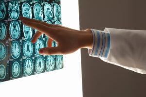 What If My Child Suffered a Brain Injury in an Accident in Kansas or Missouri?