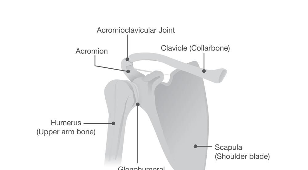 ¿Necesitas un abogado para una clavícula rota después de un accidente en Missouri o Kansas?