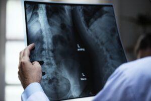 What’s a Fair Settlement Value for a Neck Injury from a Kansas City Accident?