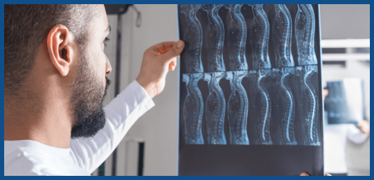 Spinal Cord Injury